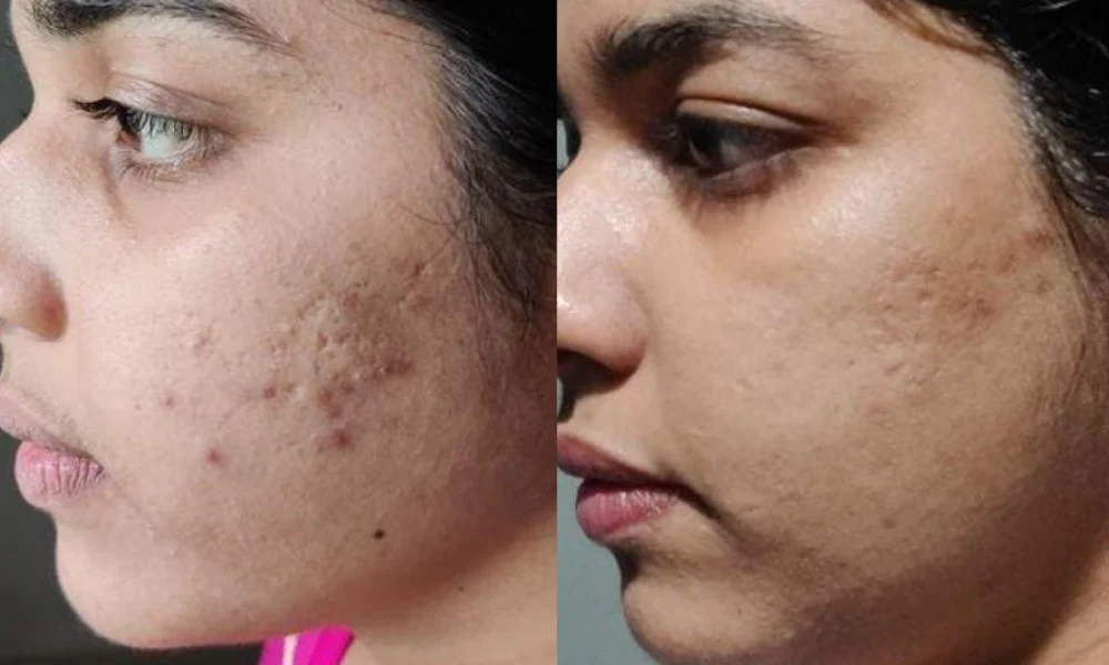 herbal skincare product