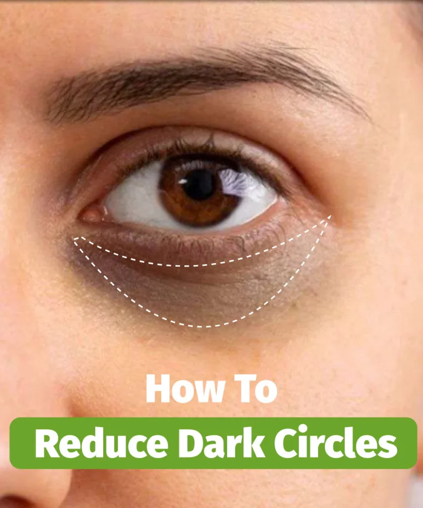 Dark Circles Naturally